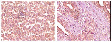 EphA2 Antibody