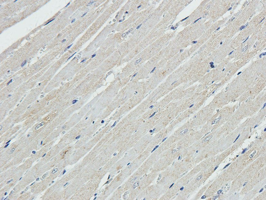 EPHA4 antibody