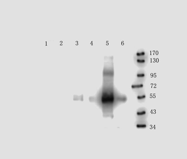 EPHA4 antibody