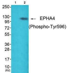 EPHA4 (Phospho-Tyr596) Antibody