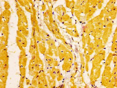 EPHA6 Antibody