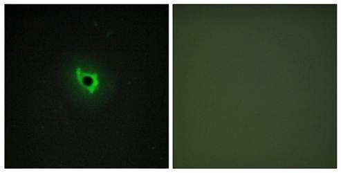 EPHA6 Antibody