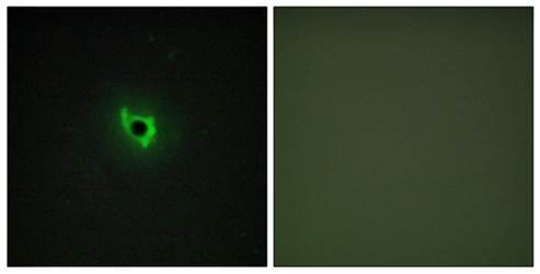 EPHA6 antibody