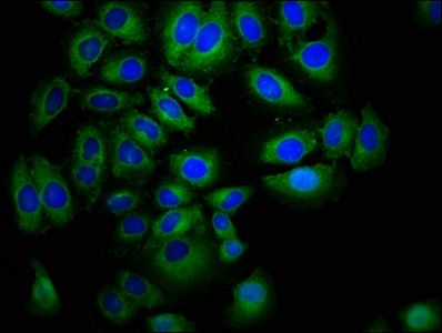 EPHA7 antibody