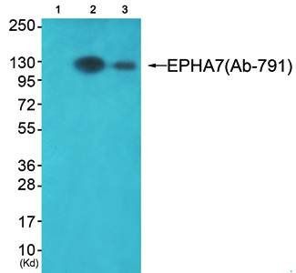 EPHA7 (Ab-791) Antibody