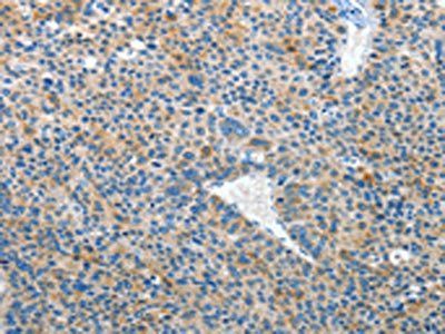 EPHB3 Antibody