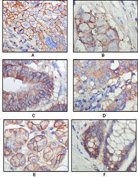 EphB3 Antibody