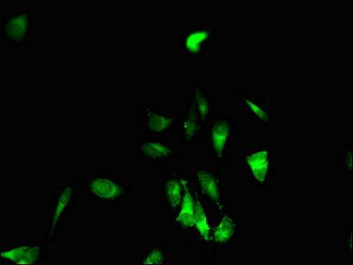 EPHB6 Antibody