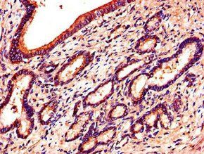 EPHB6 Antibody
