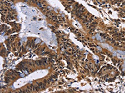 EPHB6 Antibody