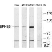 EPHB6 antibody
