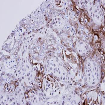 Ephrin A1 Rabbit Polyclonal Antibody