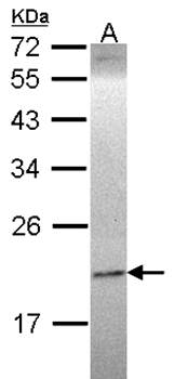 Ephrin A1 Rabbit Polyclonal Antibody