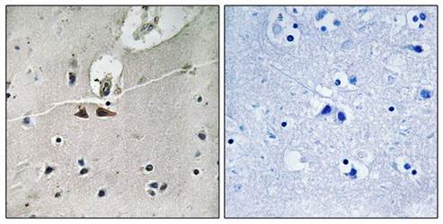 Ephrin B1/B2/B3 (Phospho-Tyr324) Antibody
