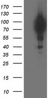 EPHX2 Antibody