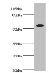 EPHX2 Antibody