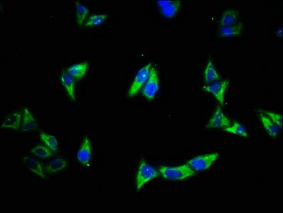 Epidermal growth factor R antibody