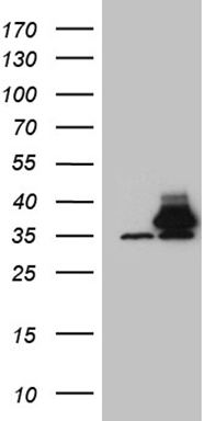 LIMA1 Antibody