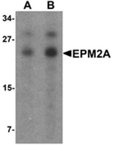 EPM2A Rabbit Polyclonal Antibody