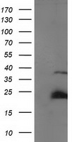 EPM2AIP1 Antibody
