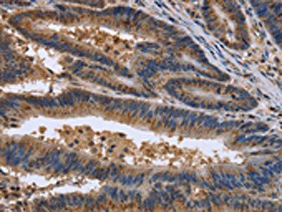 EPOR Antibody