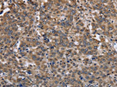 EPOR Antibody