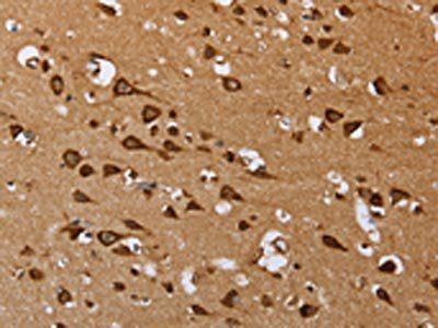 EPOR Antibody