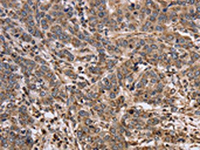 EPOR Antibody