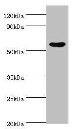 Epoxide hydrolase 1 antibody