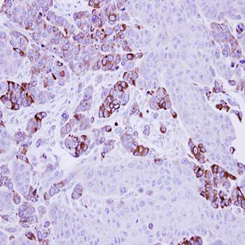 Epoxide hydrolase 1 antibody
