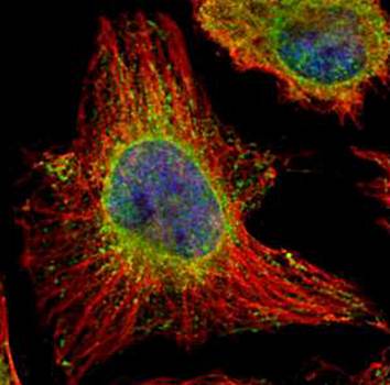 Epoxide hydrolase 1 antibody