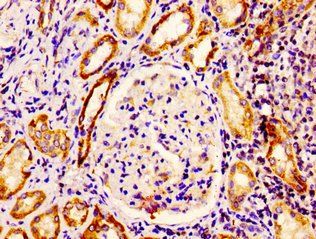 EPS8 Antibody