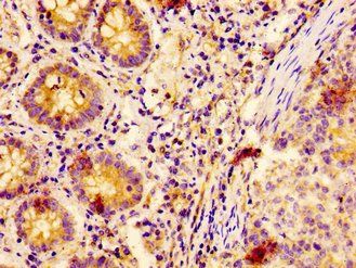 EPS8 Antibody