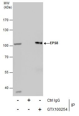 EPS8 antibody [C3], C-term
