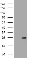 EPN2 Antibody