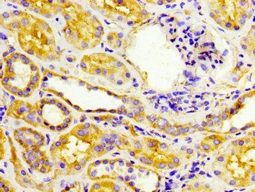 EPSTI1 Antibody