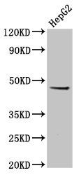 EPSTI1 antibody