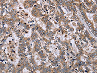 EPSTI1 Antibody