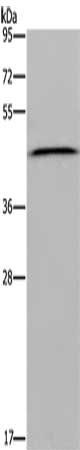 EPSTI1 antibody