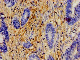 ERAL1 Antibody