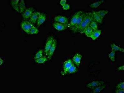 ERAP1 antibody