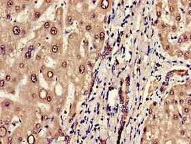 ERAP1 antibody