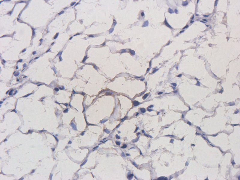erbB-2 (Her-2/neu) antibody