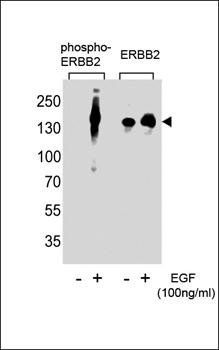 HER2 (phospho-Tyr1248) antibody