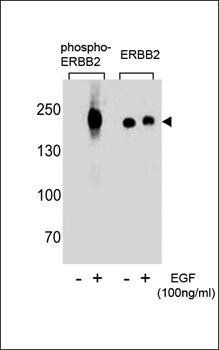 HER2 (phospho-Tyr1248) antibody