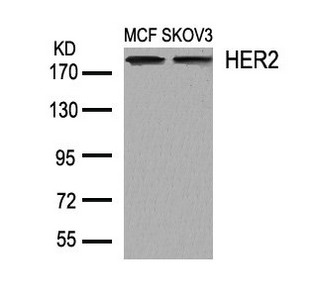 ERBB2 (Ab-1248) antibody