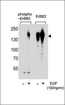 ERBB2 antibody