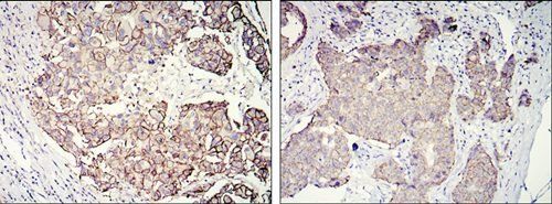 ERBB2 Antibody