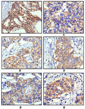 ERBB2 Antibody