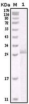ERBB2 Antibody